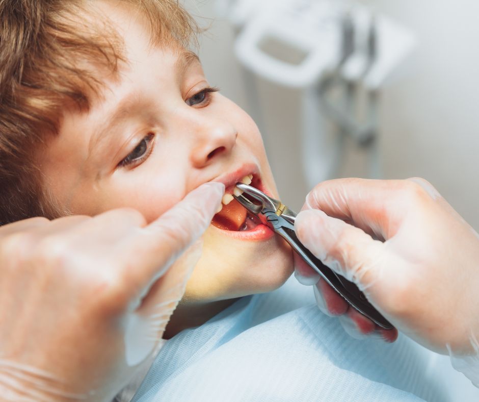 Pediatric Tooth Extractions for Kids in Beaverton, OR Tooth + Tusk